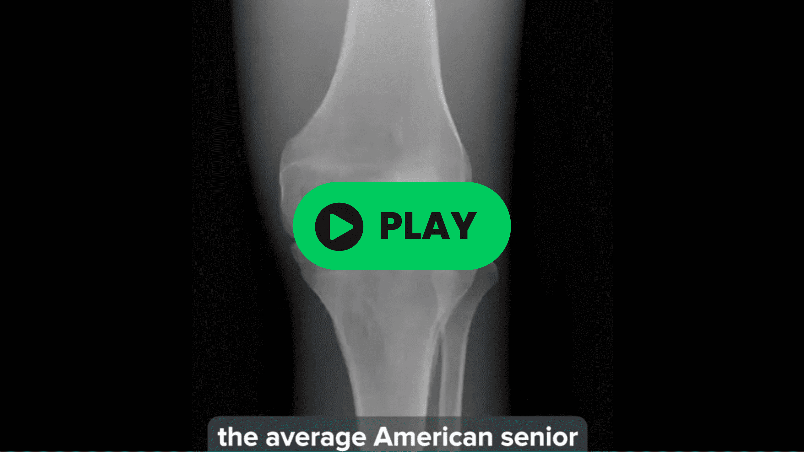 thumbnail video to presentation